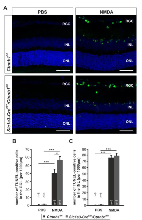 Abb. 7: Wnt/β-Catenin-Defizienz in Müllerzellen steigert die Apoptose von retinalen Neuronen A: Repräsentative TUNEL-Färbung meridionaler Paraffinschnitte von Retinae 8 Wochen alter  Slc1a3-Cre ERT /Ctnnb1 fl/fl -  und  Ctnnb1 fl/fl -Mäuse  24h  nach  Inje