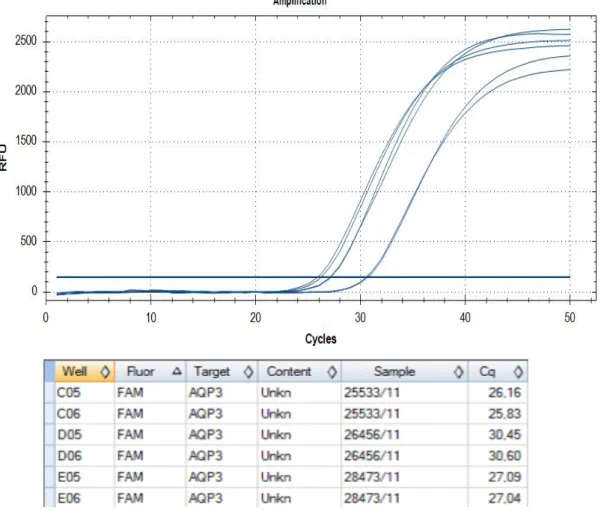 Abb. 4: Screenshot aus Biorad CFX Manager Software - Graphische Darstellung der RFU in Abhängigkeit  der Zyklen einer AQP3 Messung