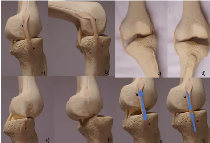 Abbildung 5: Beweglichkeit des Kniegelenkes: Extension (a) und Flexion (b), tibiale 