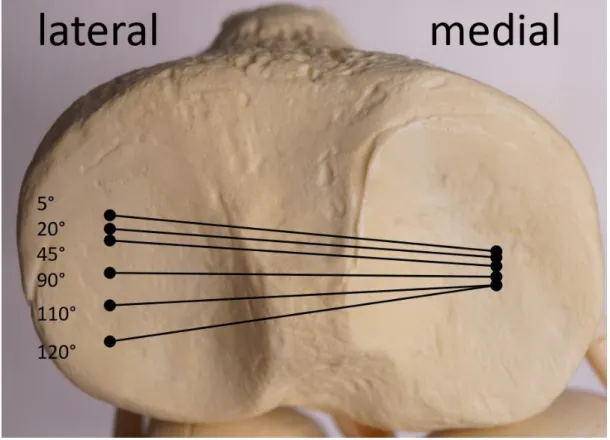 Abbildung 9: Die dynamische Analyse der Position des Kontaktpunktes der femoralen  Kondylen relativ zu der proximalen Tibiaoberfläche in der Flexion (°) zeigt eine 