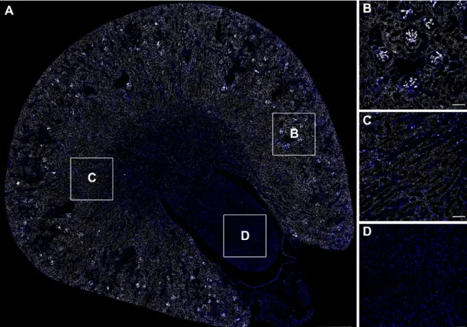 Abbildung 4. Übersicht der in-situ Hybridisierung zur Detektion der AT 1A  mRNA (weiß) auf einem  Nierenschnitt  einer  Wildtypmaus  (A)  und  Ausschnitte  aus  verschiedenen  Nierenzonen  in  höherer Vergrößerung (B-D)