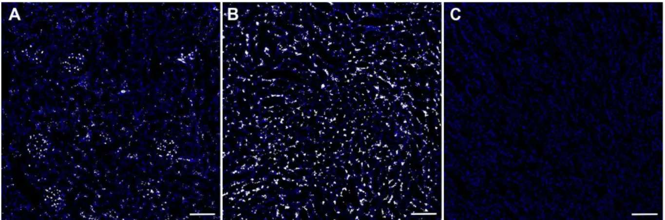 Abbildung  9.  In-situ  Hybridisierung  der  AT 1A   mRNA  (weiß)  in  verschiedenen  Zonen  einer  Rattenniere