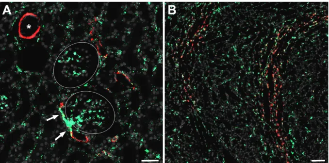 Abbildung 10. In-situ Hybridisierung der AT 1A  (grün) und α-SMA mRNA (rot) auf einem kortikalen  Ausschnitt  (A)  und  einem  Ausschnitt  der  äußeren  Medulla  (B)  einer  Rattenniere