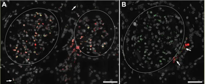 Abbildung 12. In-situ Hybridisierung der AT 1  (grün), PDGFR-β (rot, A) und Renin mRNA (rot, B)  auf humanen Nierenschnitten