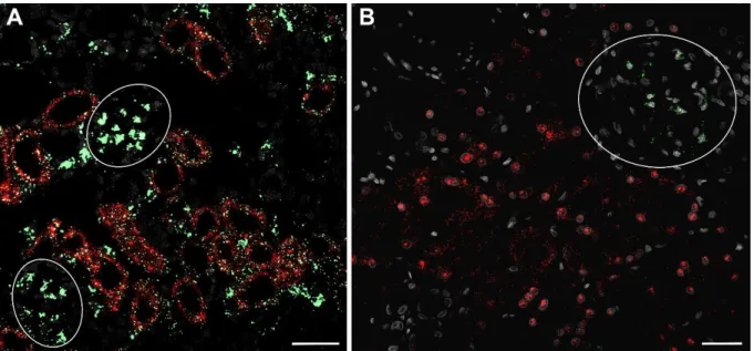 Abbildung 13. In-situ Hybridisierung der AT 1(A)  (grün) und SGLT2 mRNA (rot) auf murinen (A) und  humanen (B) Nierenschnitten