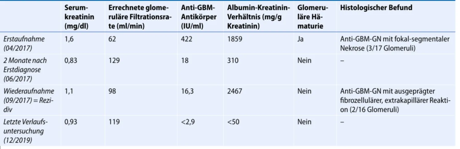 Tab. 1 Zeitlicher Verlauf der laborchemischen und klinischen Parameter  Serum-kreatinin (mg/dl) Errechnete  glome-ruläre Filtrationsra-te (ml/min)  Anti-GBM-Antikörper(IU/ml) Albumin-Kreatinin-Verhältnis (mg/gKreatinin) Glomeru-läre Hä-maturie Histologisch