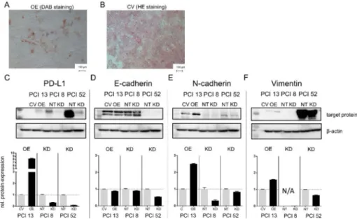 Figure 1. PD-L1 dependent expression of EMT markers. (A) Programmed cell death ligand-1 (PD-L1)-dependent expression of epithelial-to-mesenchymal transition (EMT) markers in 3D cultured cells may lead to morphological changes