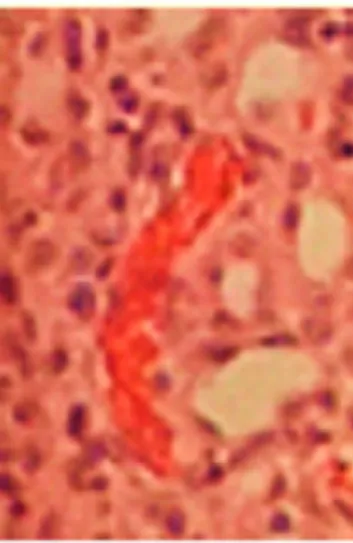 Figure 2. Details from a microphotograph in transillumination of blood stasis in a HE-stained tissue sample removed from the kidney medulla after application of Contrast Media