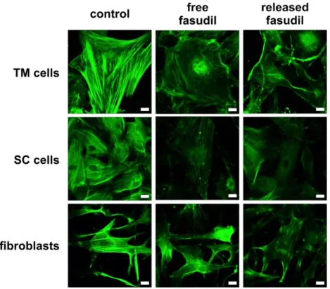 Figure 4. Free and released fasudil disrupt actin stress fibers. Representative fluorescence microscopic  images of the actin cytoskeleton