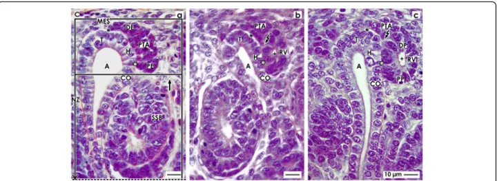 Fig. 2 View onto a the pretubular aggregate (PTA), b the mesenchymal to epithelial transition, and c the primitive renal vesicle (RV) in the fetal human kidney by optical microscopy
