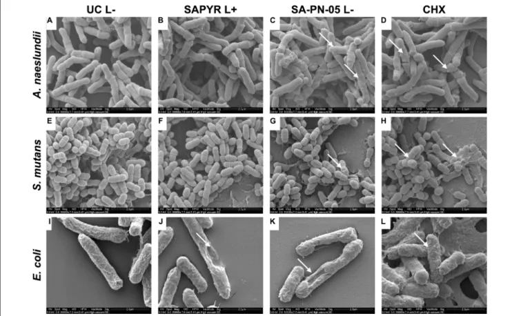 FIGURE 4 | Exemplary visualization of single-species biofilms by means of scanning electron microscopy (SEM)