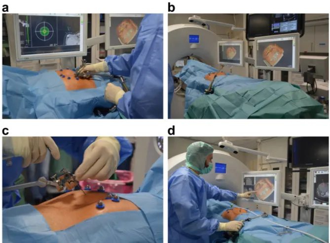 Figure 1.  Setup and operation of the navigation system for ablation of malignant liver tumors