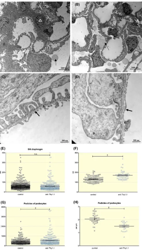 FIGURE 8  Electron microscopy studies visualize the ultrastructural consequences of mesangial cell depletion