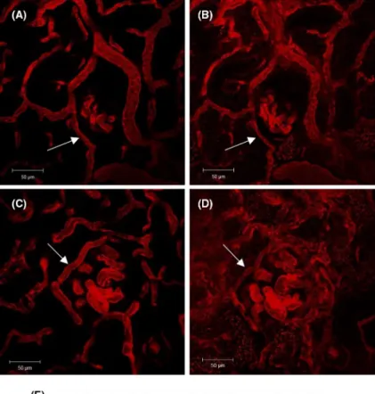 FIGURE 5  Diameter of afferent  arterioles: The afferent arteriole diameter  was determined in control rats before  (A) and after (B) a 20- minute infusion of  angiotensin II (80 ng/kg/min)