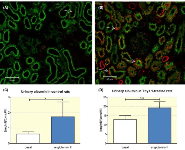 FIGURE 7  Urinary albumin excretion in control and anti- Thy1.1- treatd rats. Immunostaining illustrates the tubular uptake of albumin in  control (A) and anti- Thy1.1- treated rats (B) (thin arrows)