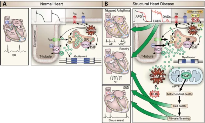 Abbildung 4: Die Rolle der CaMKII im gesunden Herzen und in der Pathophysiologie 