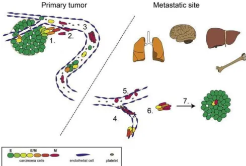 Figure 4: Metastatic cascade with involvement of EMT and MET. Tumor cells undergo EMT to acquire the potential to start  local tissue invasion (1) and migration towards blood vessels