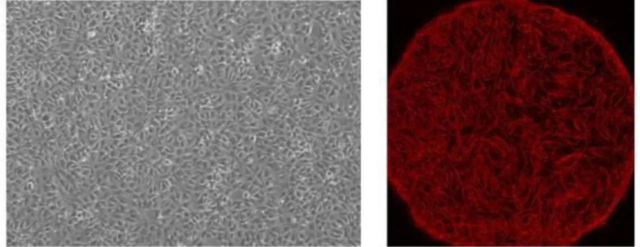 Figure 6: Left panel: post-confluent HUVECs, before seeding MVN; Right panel: Microvascular net at day 7 after seeding 