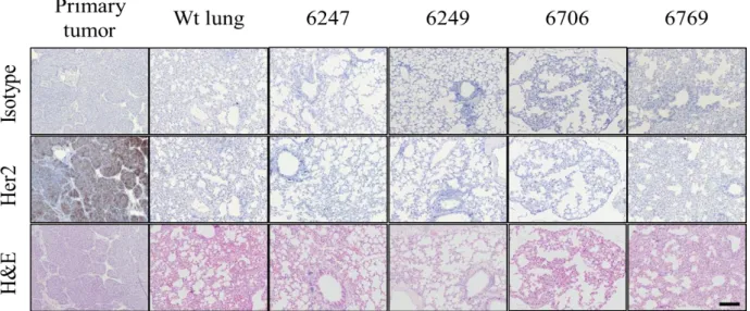 Figure  20:  Her2  staining  of  the  lungs  of  recipients  of  BM  from  transgenic  mice