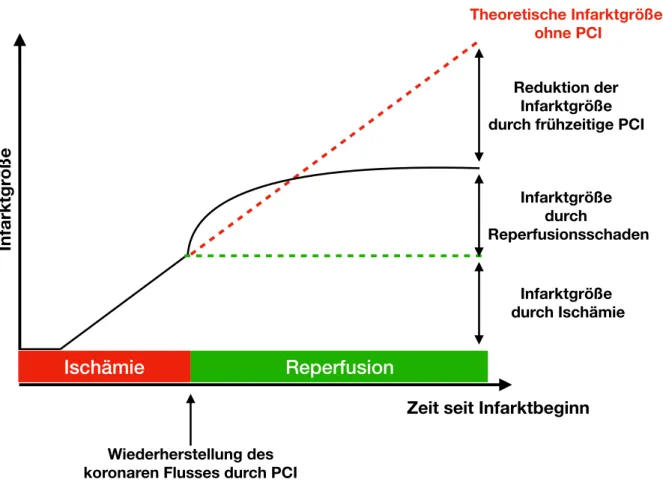 Abbildung 5 – Myokardiale Infarktgröße in Abhängigkeit von der Zeit bis PCI sowie Darstellung des Anteils des  Reperfusionsschadens