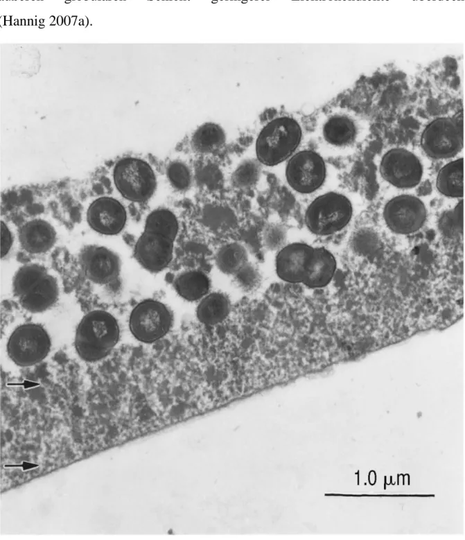 Abbildung 2.   Aufnahme des Pellikels mit einem Transmissionselektronenmikroskop. Deutlich erkennbar  ist eine basale elektronendichte Schicht mit einer bedeckenden globulären Schicht 