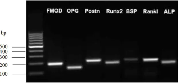 Abb. 2. Agarose-Gelelektrophorese der Gene für die Charakterisierung von PDL-Fibroblasten  (Aufnahme: Oralbiologisches Labor, Poliklinik für Kieferorthopädie, Universitätsklinikum  Re-gensburg)