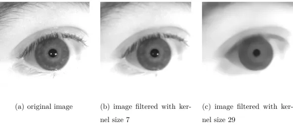 Figure 2.1: The two images on the right depict the effect of Median Filtering with kernel sizes of 7 and 29 respectively, on an image from the self-recorded database (see chapter 4)