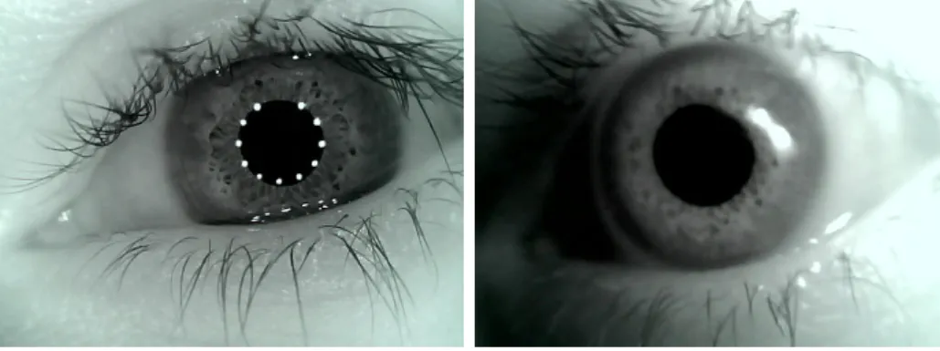 Figure 3.3: Pictures of the same eye, recorded with the Foscam camera, with and without the built-in IR LEDs