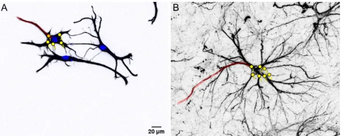 Figure 6.  Quantification of length (red lines) and number (yellow dots) of primary GFAP+ processes of astrocytes  in vitro and in vivo using ImageJ