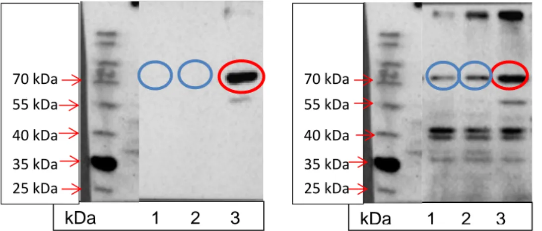 Abbildung 11 Western Blot der  Brustkrebszelllinie T-47-D  zum Nachweis des  icb-1 knockdowns auf  Proteinebene 