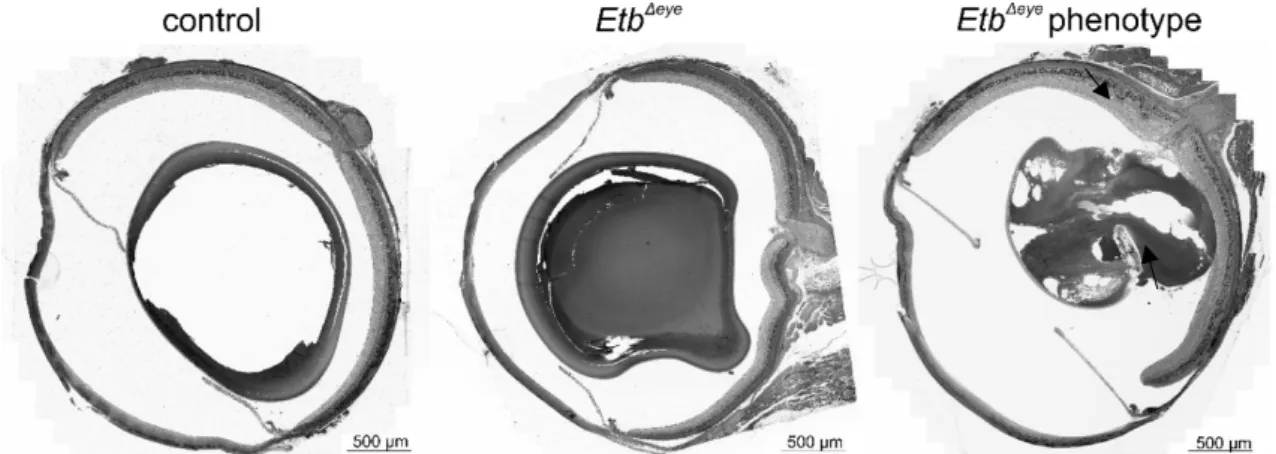 Figure 14 Semithin-sections of the entire eye of 6 week-old control mouse.(A) Etb Δeye  mouse without a lens- lens-specific phenotype (Etb Δeye ) and a Etb Δeye  mouse with a lens-specific phenotype (Etb Δeye  phenotype)