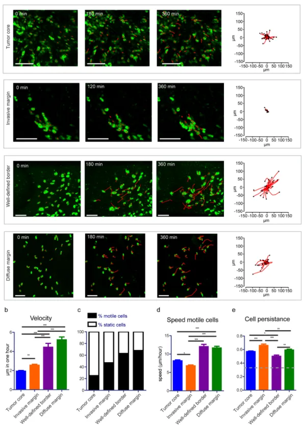 Figure 2.  Migratory behavior of tumor cells at different border configurations. (a) Representative still images  from a time-lapse movie showing migrating tumor cells from different border configurations