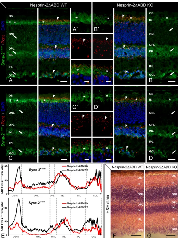 Figure 1. Light microscopic and immunofluorescence analysis of Pcnt and Syne-2 in retinae of  2ΔABD mouse strain