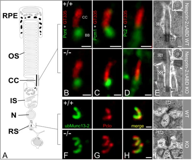 Figure 3. High-resolution microscopical analysis of the basal body complex and the ribbon synapse of Nesprin-2 4 ABD mouse strain (age 2–4 month)