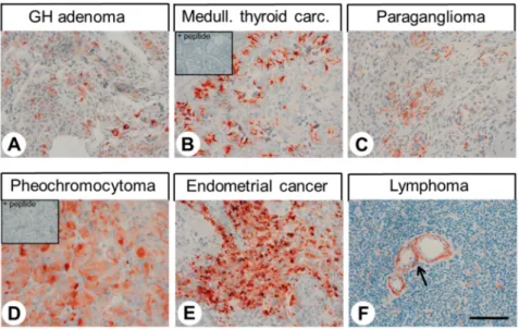 Figure 7. Immunohistochemical detection of GPR68 localisation in different human tumour entities.