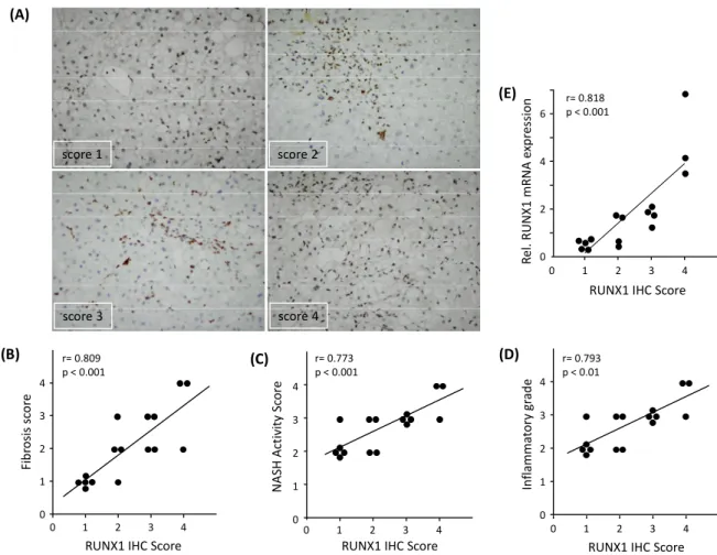 Figure 2. Immunohistochemical (IHC) analysis of RUNX1 expression in NASH patients. (A) RUNX1  immunostained images (20× objective) with an increasing number of brown nuclear  immuno-positive cells (score 1–4)
