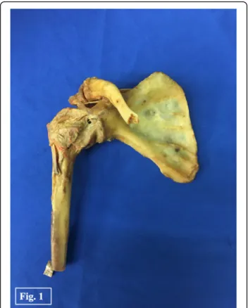 Fig. 1 Dissected specimens: Human cadaveric shoulder with preserved joint capsule and biceps pulley