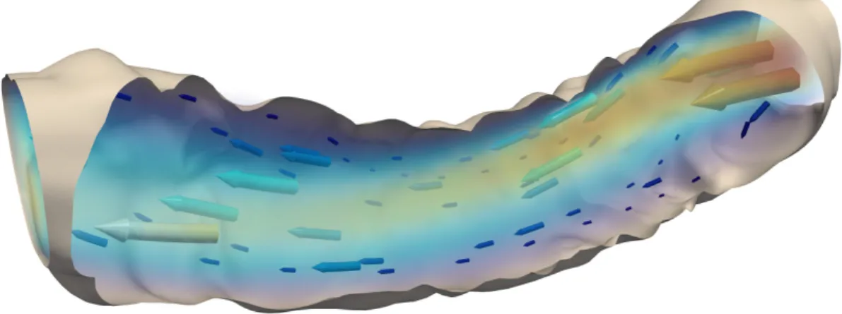 FIGURE 6 Solution of the time-dependent Navier-Stokes problem at time 1.0 s for the coronary artery; cf