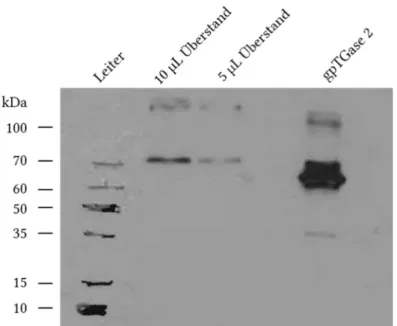 Abb. 16 Western-Blot zur Detektion von hTGase 2 im Überstand der HEK293 EBNA Zellen. 