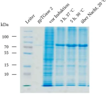 Abb. 17 Coomassiefärbung von Totallysaten von E. coli zu den drei gewählten Expressionsbedingungen 
