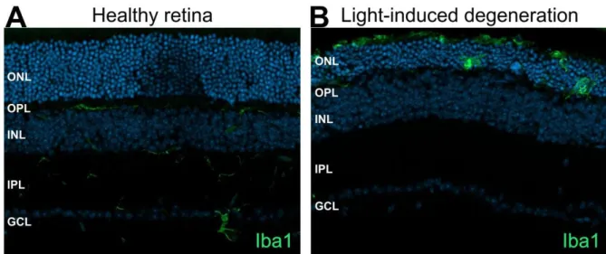 Figure 2: Microglial retinal location and appearance during health and disease. (A) In the healthy retina Iba1  positive  ramified  microglial  cells  are  located  in  the  plexiform  layers