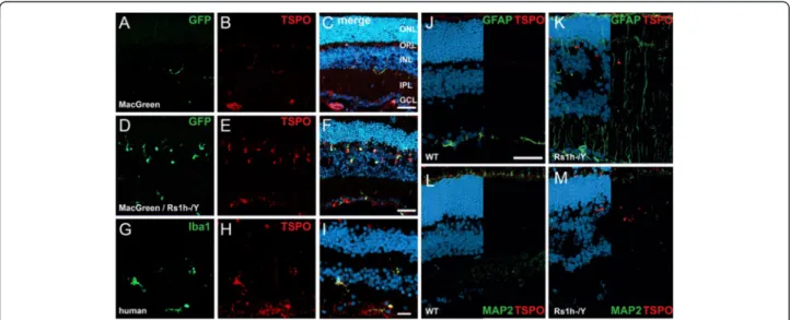 Figure 1 TSPO expression as a marker for microgliosis in degenerating and aging retinas