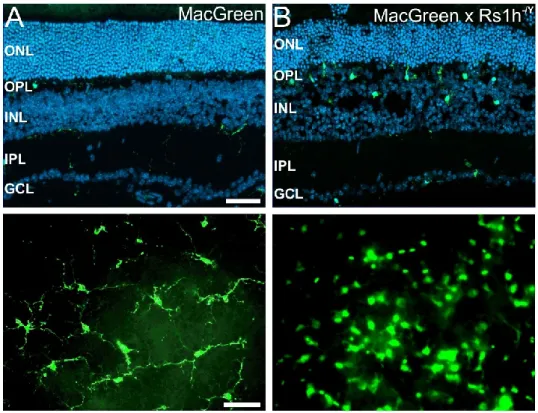 Figure  5:  Microglial  reactivity  in  the  retinoschisin-deficient  (Rs1h -/Y )  mouse  retina