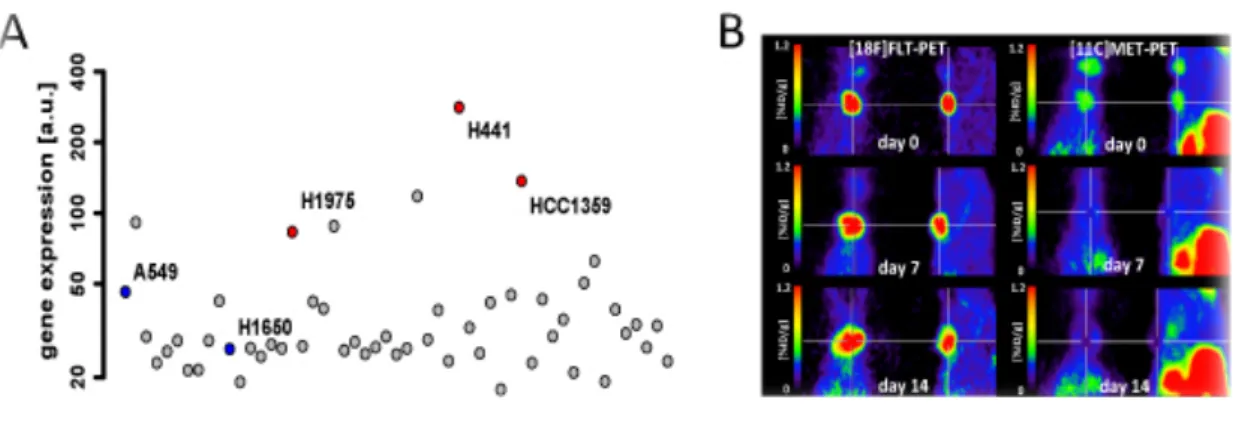 Figure 8: VEGFR2 expression profile and impact of VEGFR2 inhibition in NSCLC  A. VEGFR2 expression data from 53 NSCLC cell lines from Affymetrix U133A arrays