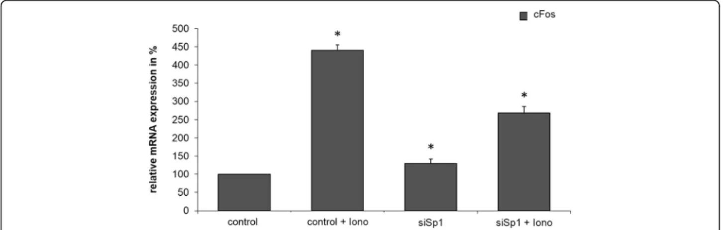 Fig. 1 a - k: Expression profile analysis depending on the treatment with Ionomycin. Four different groups of mRNA are produced from PaTu 8988t lysates: 1) Untreated control lysates, 2) Lysates from cells treated with Ionomycin 1 h previously, 3) Cell lysa