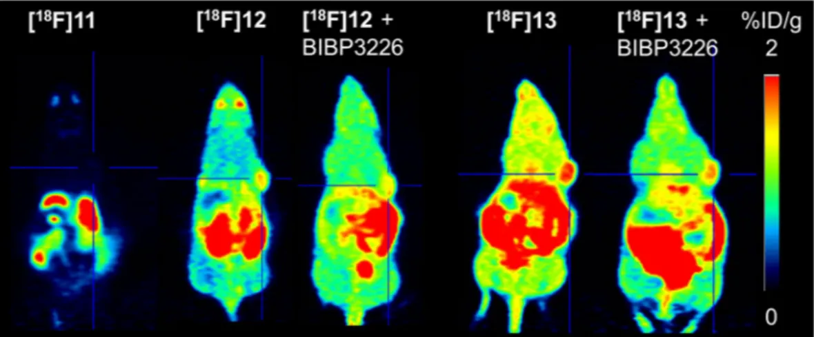 Figure 6.  PET images of in MCF-7-Y1-tumour bearing nude mice injected with Y 1 R radioligands [ 18 F]11,  [ 18 F]12 and [ 18 F]13 at 45–60 min p.i
