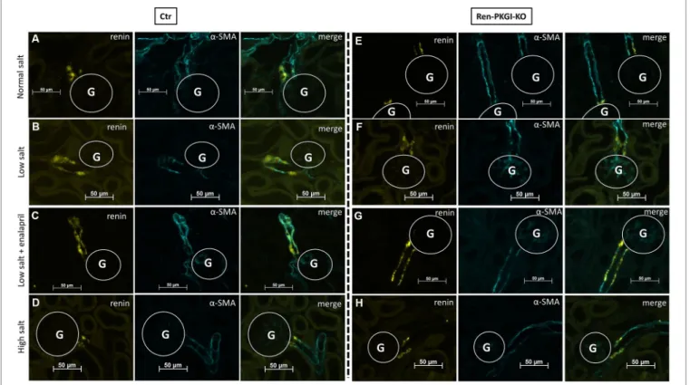 FIGURE 2 | Immunohistochemical analysis of the juxtaglomerular apparatus (JGA) during different salt loads: Representative costainings of renin (yellow) and  α -smooth muscle actin ( α -SMA, turquoise)