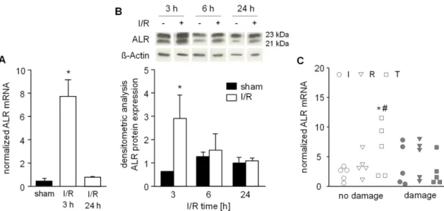 Figure 5. Hepatic ALR expression after ischemic reperfusion. A) Mice were subjected to ischemia as  described in Material and Methods and liver tissue samples were taken after 3 h or 24 h (n = 6 each)  of reperfusion