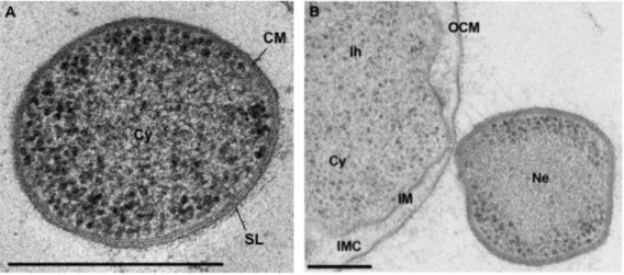 Figure 9: Transmission electron micrographs of N. equitans. 