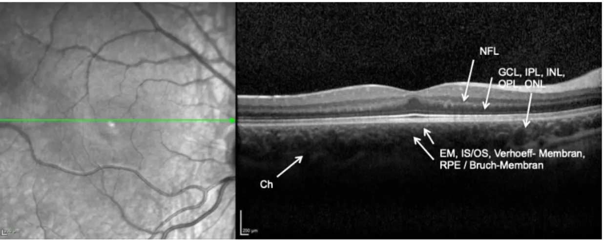 Abbildung 2: Optische Kohärenztomografie (OCT): Darstellung der einzelnen Retina-Schich- Retina-Schich-ten 